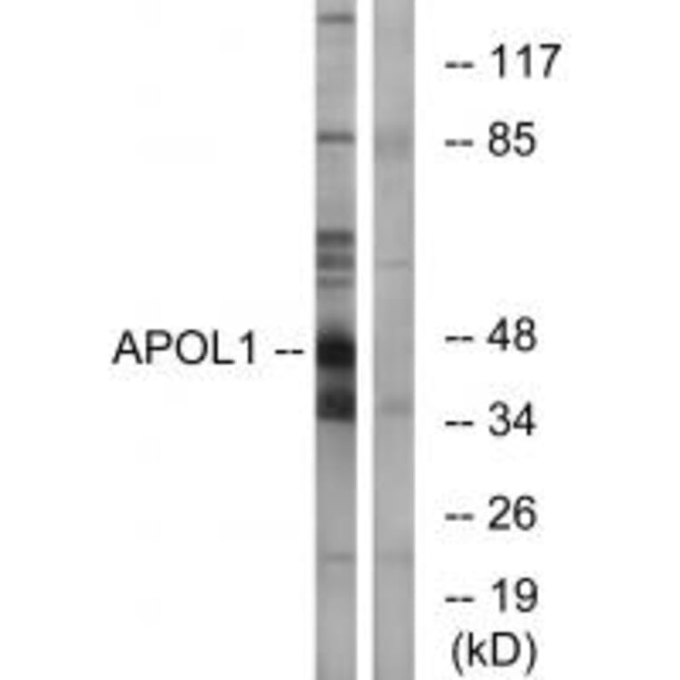 Western blot - APOL1 Antibody from Signalway Antibody (34431) - Antibodies.com