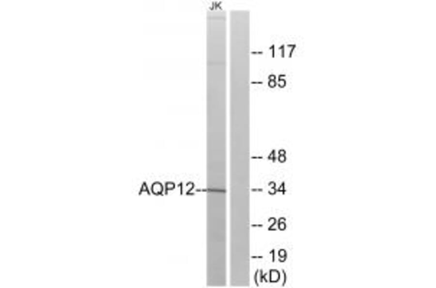 Western blot - AQP12 Antibody from Signalway Antibody (34435) - Antibodies.com