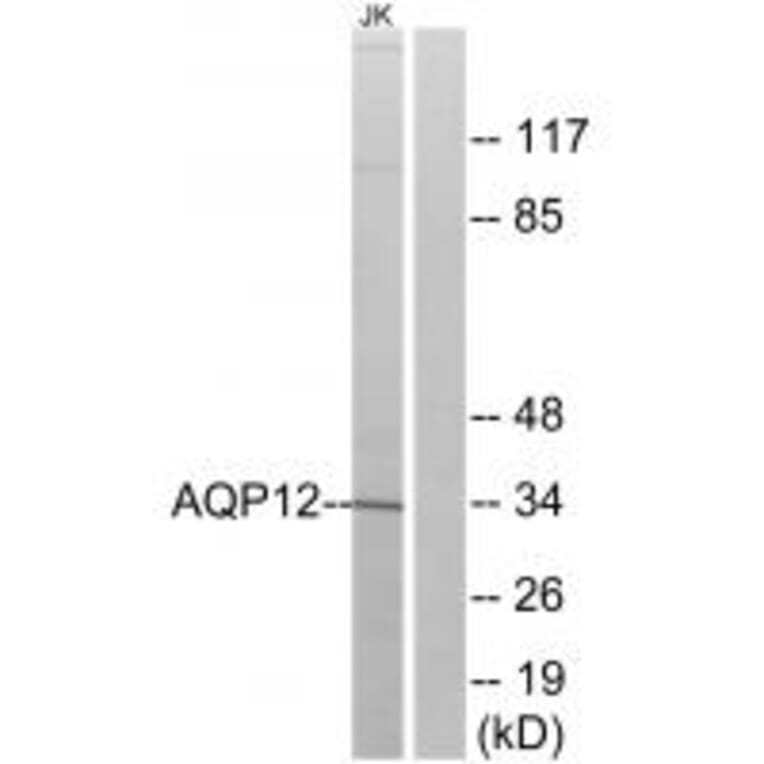 Western blot - AQP12 Antibody from Signalway Antibody (34435) - Antibodies.com