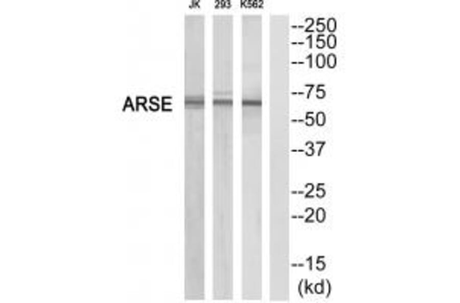 Western blot - ARSE Antibody from Signalway Antibody (34442) - Antibodies.com
