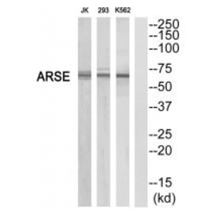 Western blot - ARSE Antibody from Signalway Antibody (34442) - Antibodies.com