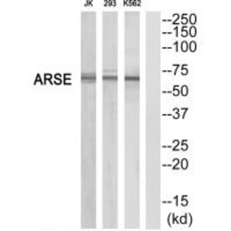 Western blot - ARSE Antibody from Signalway Antibody (34442) - Antibodies.com