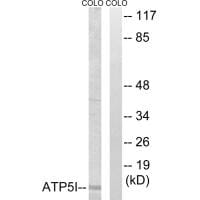Western blot analysis of extracts from COLO cells, using ATP5I antibody #34448.
