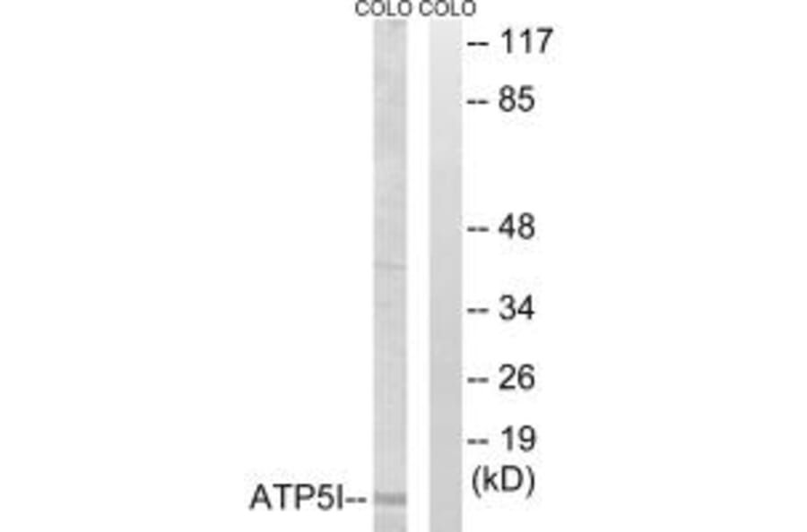 Western blot - ATP5I Antibody from Signalway Antibody (34448) - Antibodies.com