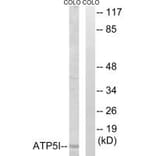 Western blot - ATP5I Antibody from Signalway Antibody (34448) - Antibodies.com