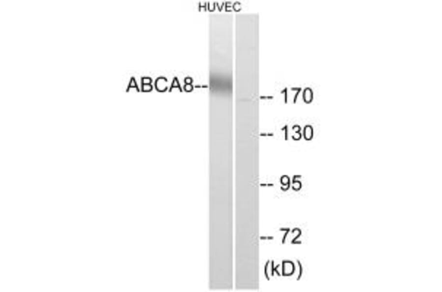 Western blot - ABCA8 Antibody from Signalway Antibody (34458) - Antibodies.com