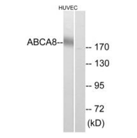 Western blot - ABCA8 Antibody from Signalway Antibody (34458) - Antibodies.com