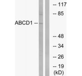 Western blot - ABCD1 Antibody from Signalway Antibody (34461) - Antibodies.com