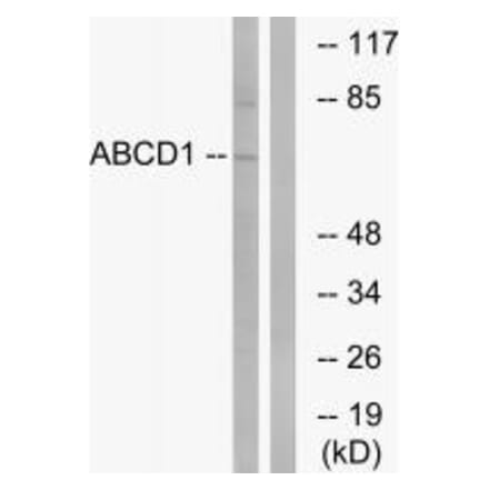 Western blot - ABCD1 Antibody from Signalway Antibody (34461) - Antibodies.com