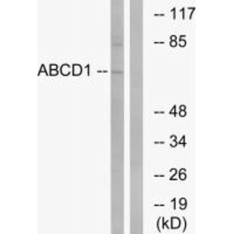 Western blot - ABCD1 Antibody from Signalway Antibody (34461) - Antibodies.com