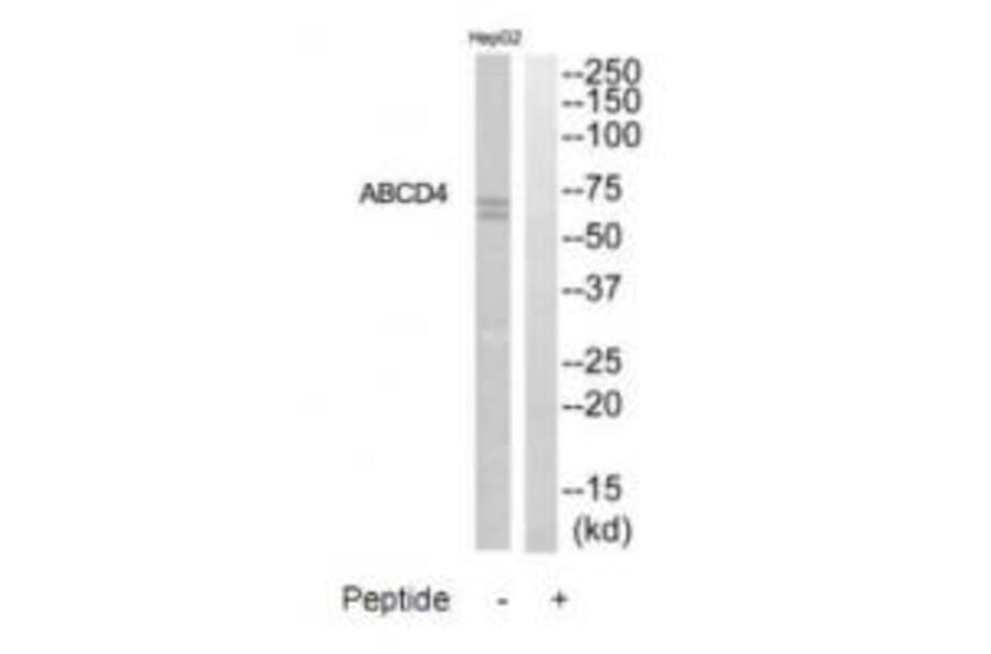 Western blot - ABCD4 Antibody from Signalway Antibody (34462) - Antibodies.com