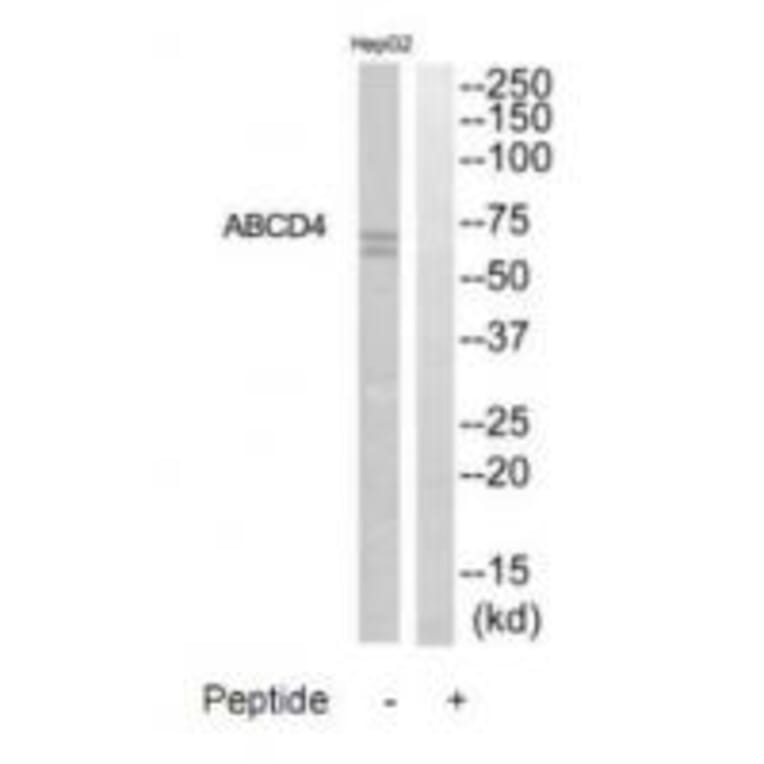 Western blot - ABCD4 Antibody from Signalway Antibody (34462) - Antibodies.com