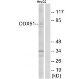 Western blot - DDX51 Antibody from Signalway Antibody (34468) - Antibodies.com