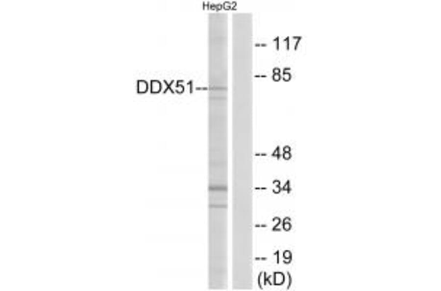 Western blot - DDX51 Antibody from Signalway Antibody (34468) - Antibodies.com