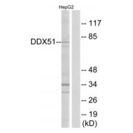 Western blot - DDX51 Antibody from Signalway Antibody (34468) - Antibodies.com