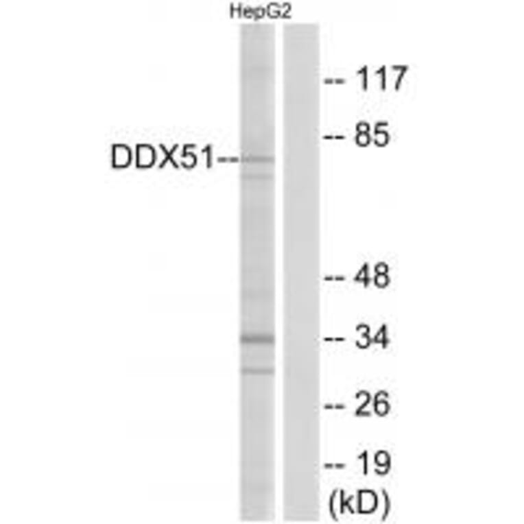 Western blot - DDX51 Antibody from Signalway Antibody (34468) - Antibodies.com