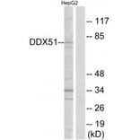 Western blot - DDX51 Antibody from Signalway Antibody (34468) - Antibodies.com