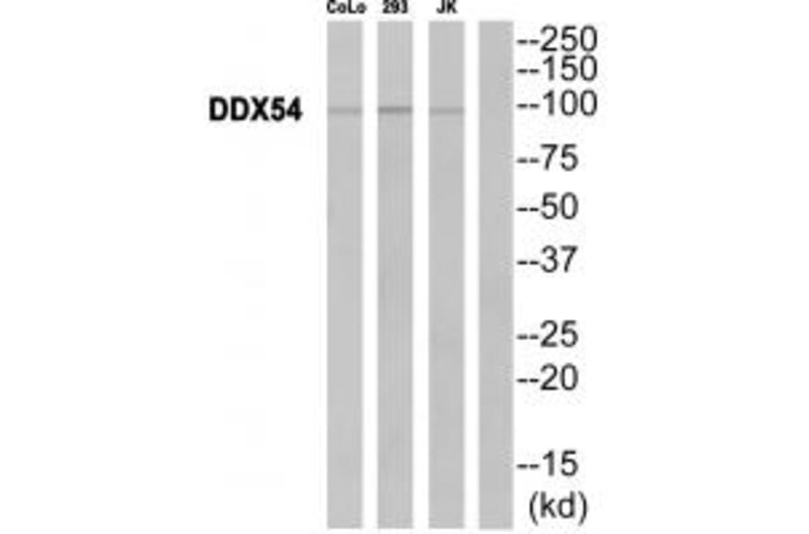 Western blot - DDX54 Antibody from Signalway Antibody (34469) - Antibodies.com