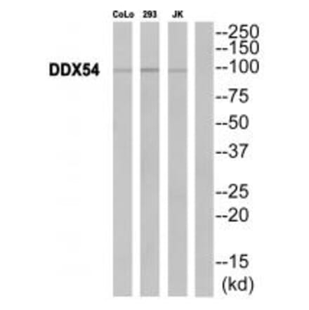 Western blot - DDX54 Antibody from Signalway Antibody (34469) - Antibodies.com