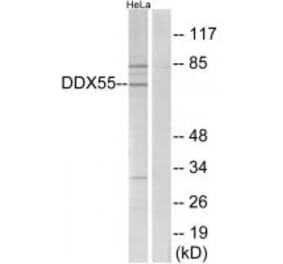 Western blot - DDX55 Antibody from Signalway Antibody (34470) - Antibodies.com