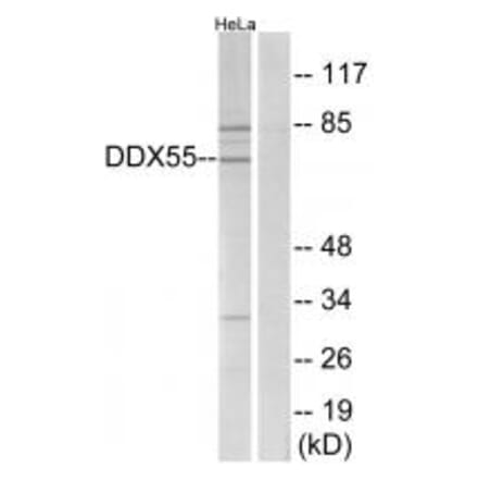 Western blot - DDX55 Antibody from Signalway Antibody (34470) - Antibodies.com