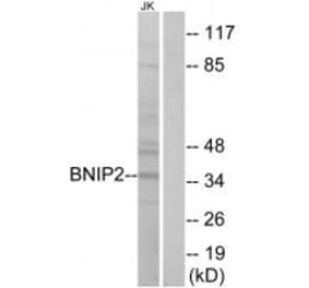 Western blot - BNIP2 Antibody from Signalway Antibody (34480) - Antibodies.com
