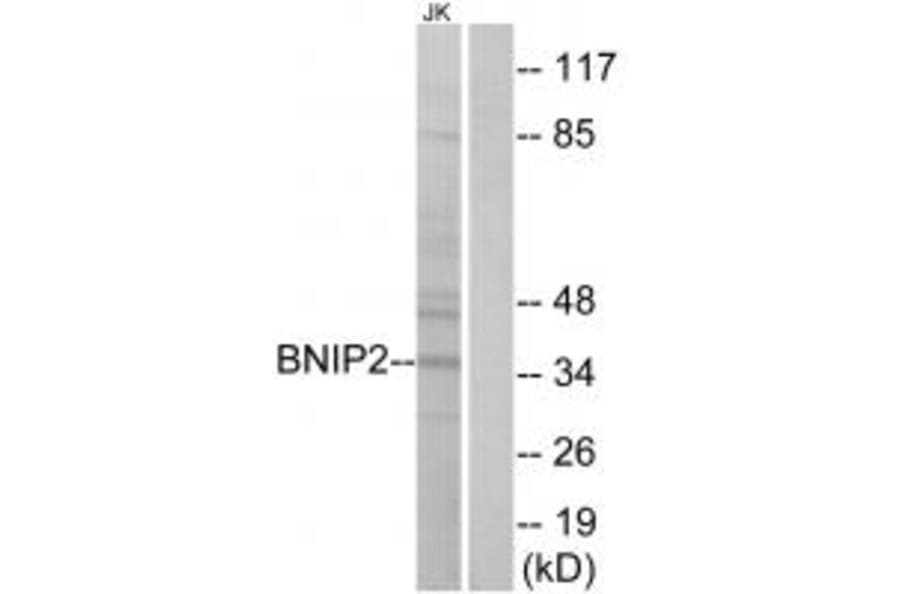 Western blot - BNIP2 Antibody from Signalway Antibody (34480) - Antibodies.com