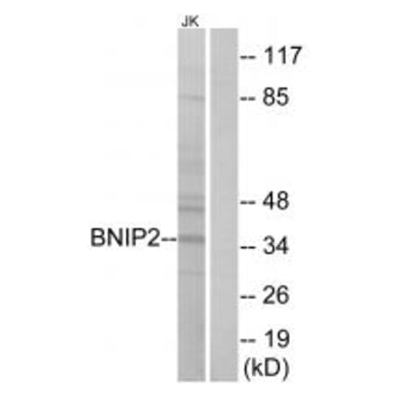Western blot - BNIP2 Antibody from Signalway Antibody (34480) - Antibodies.com