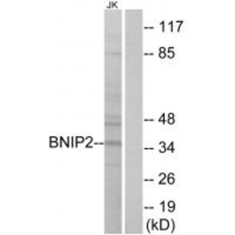 Western blot - BNIP2 Antibody from Signalway Antibody (34480) - Antibodies.com