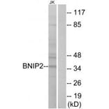 Western blot - BNIP2 Antibody from Signalway Antibody (34480) - Antibodies.com