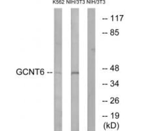Western blot - GCNT6 Antibody from Signalway Antibody (34484) - Antibodies.com