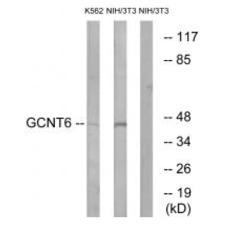 Western blot - GCNT6 Antibody from Signalway Antibody (34484) - Antibodies.com
