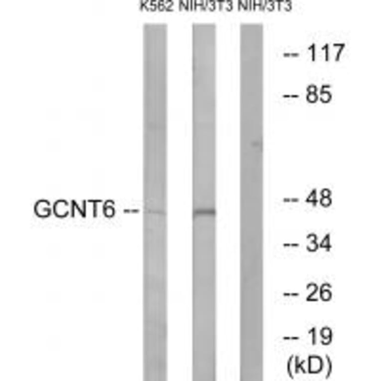 Western blot - GCNT6 Antibody from Signalway Antibody (34484) - Antibodies.com