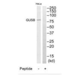 Western blot - GUSB Antibody from Signalway Antibody (34496) - Antibodies.com