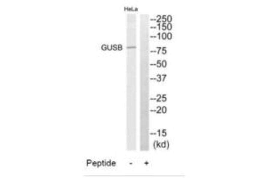 Western blot - GUSB Antibody from Signalway Antibody (34496) - Antibodies.com