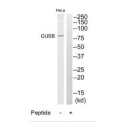 Western blot - GUSB Antibody from Signalway Antibody (34496) - Antibodies.com