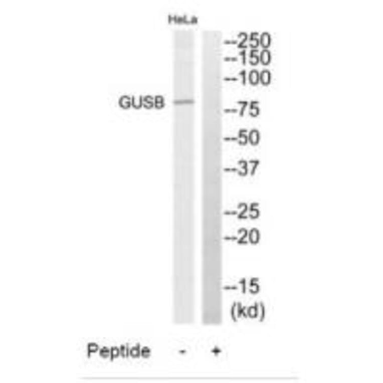 Western blot - GUSB Antibody from Signalway Antibody (34496) - Antibodies.com