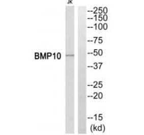 Western blot - BMP10 Antibody from Signalway Antibody (34499) - Antibodies.com