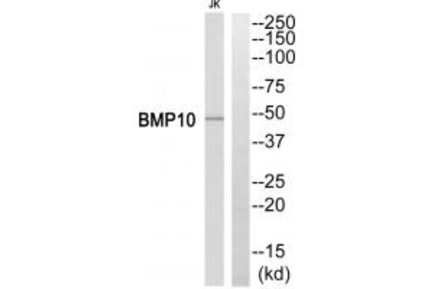 Western blot - BMP10 Antibody from Signalway Antibody (34499) - Antibodies.com