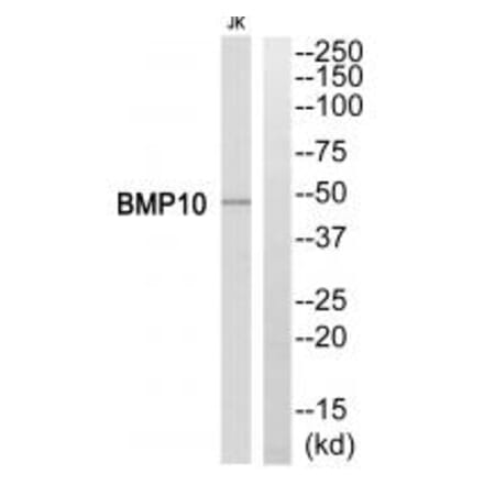 Western blot - BMP10 Antibody from Signalway Antibody (34499) - Antibodies.com
