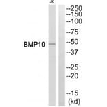 Western blot - BMP10 Antibody from Signalway Antibody (34499) - Antibodies.com