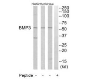 Western blot - BMP3 Antibody from Signalway Antibody (34500) - Antibodies.com
