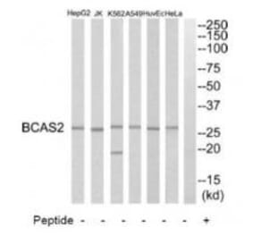 Western blot - BCAS2 Antibody from Signalway Antibody (34508) - Antibodies.com