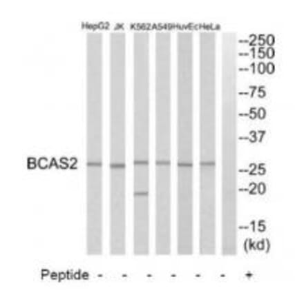 Western blot - BCAS2 Antibody from Signalway Antibody (34508) - Antibodies.com