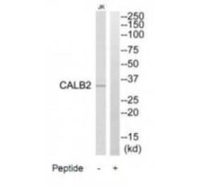 Western blot - CALB2 Antibody from Signalway Antibody (34523) - Antibodies.com