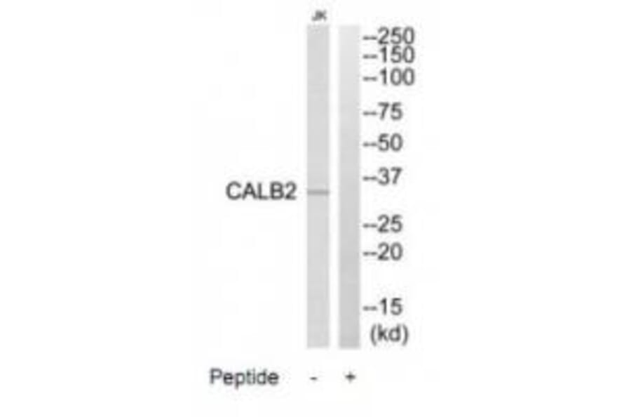 Western blot - CALB2 Antibody from Signalway Antibody (34523) - Antibodies.com