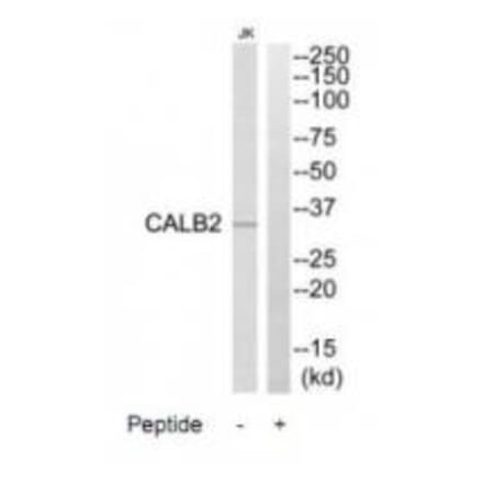 Western blot - CALB2 Antibody from Signalway Antibody (34523) - Antibodies.com