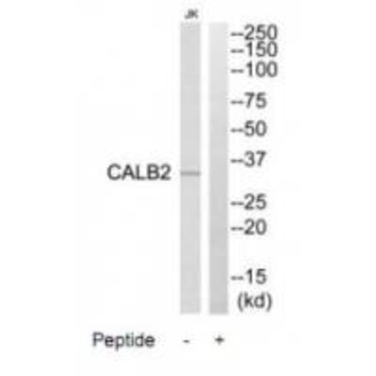 Western blot - CALB2 Antibody from Signalway Antibody (34523) - Antibodies.com