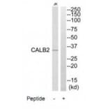 Western blot - CALB2 Antibody from Signalway Antibody (34523) - Antibodies.com