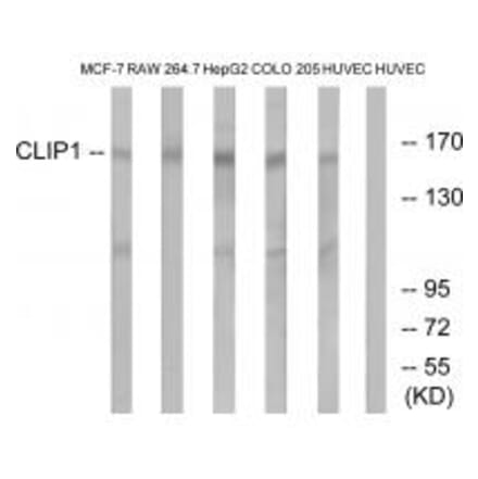 Western blot - CLIP1 Antibody from Signalway Antibody (34529) - Antibodies.com